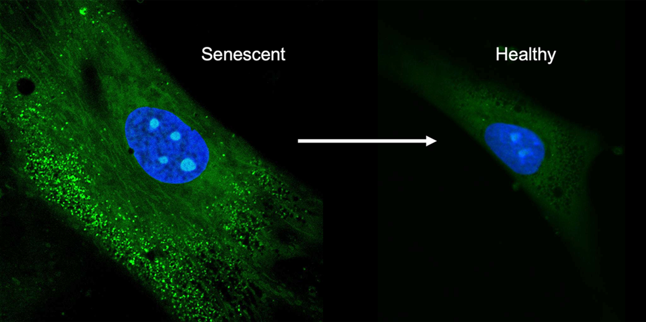 New drug delivery method can reverse senescence of stem cells