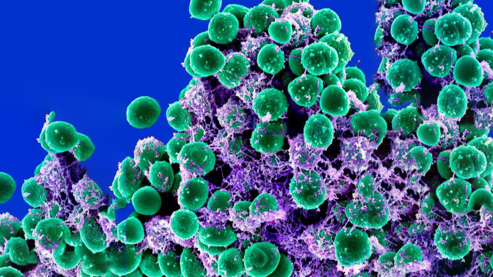 Staphylococcus epidermidis