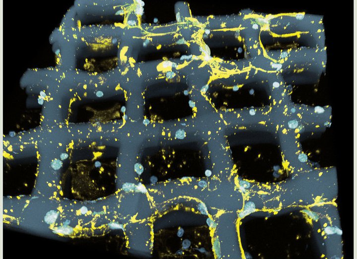 Nerve net<br /><br />
Zeiss LSM 710 Confocal Microscope