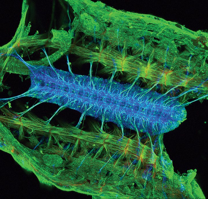 Tracing contacts<br /><br />
Zeiss LSM 710 Confocal Microscope