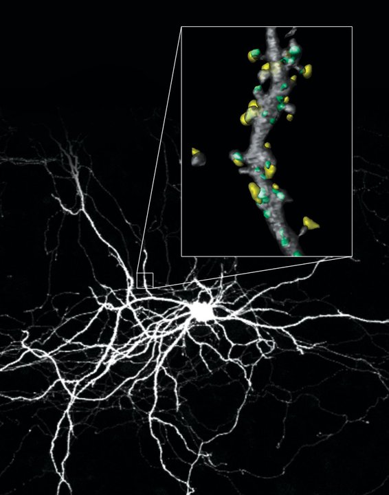 Restoring order<br /><br />
Zeiss LSM 710 Confocal Microscope