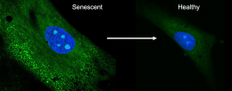 New drug delivery method can reverse senescence of stem cells