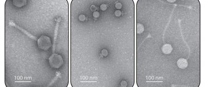 Electron micrographs of bacterial viruses, also known as phages. Photo credit is Hatoum-Aslan lab, University of Illinois Urbana-Champaign.