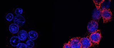 In human breast cancer cells treated with the preclinical drug ErSO (shown), or with doxorubicin, the cellular protein FGD3 causes another protein, calreticulin (in red on the right), to display on the cancer cell surface, attracting and activating immune cells. Micrographs by Junyao Zhu