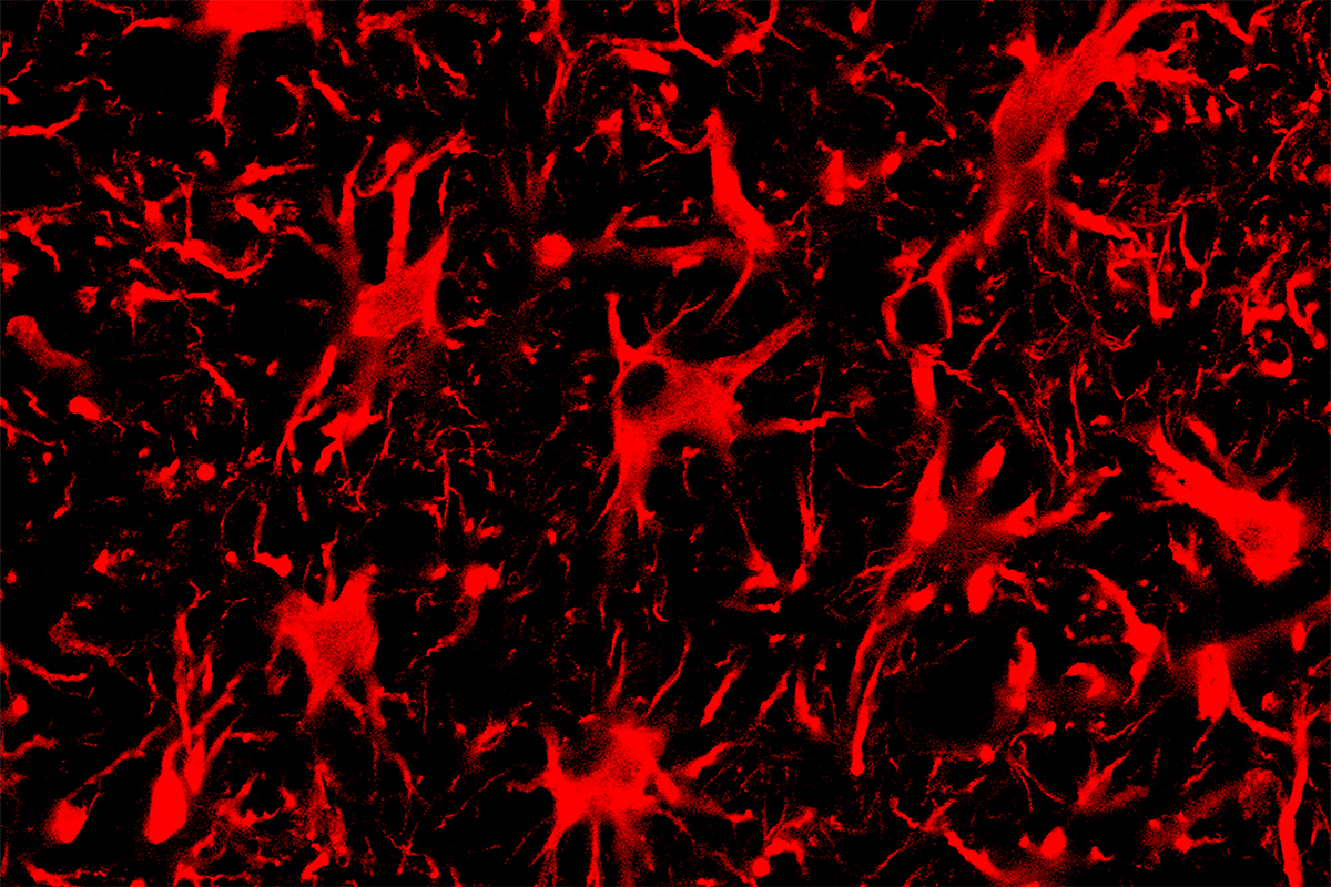 Spinal cord astrocytes, the cells seen in this fluorescent microscope image, are involved in the progression of ALS. A new CRISPR-Cas13 system targeting mutant protein production in these cells improved outcomes for mice with ALS.