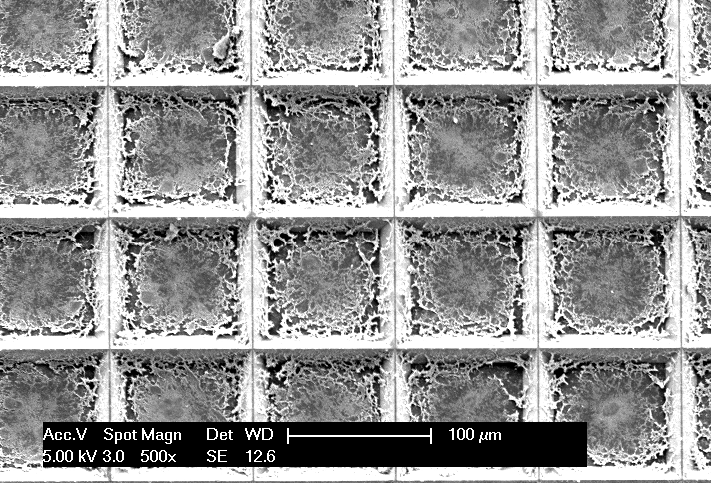 The pixelated spatial gene expression tool can analyze an entire tissue sample and identify cancer cells in a process that takes less than two hours. 