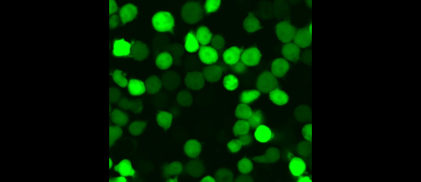 Microscopy image of a T-cell population harboring a shortened form of the HIV virus that expresses a green fluorescent protein. Different drug treatments result in the various amounts of cell-to-cell variability in gene expression.