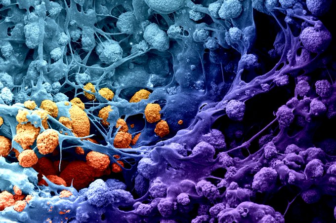 A microscopic image of the innovative biomaterial being developed from 3D-printed mesh combined with a collagen-based scaffold to regenerate large portions of the skull.