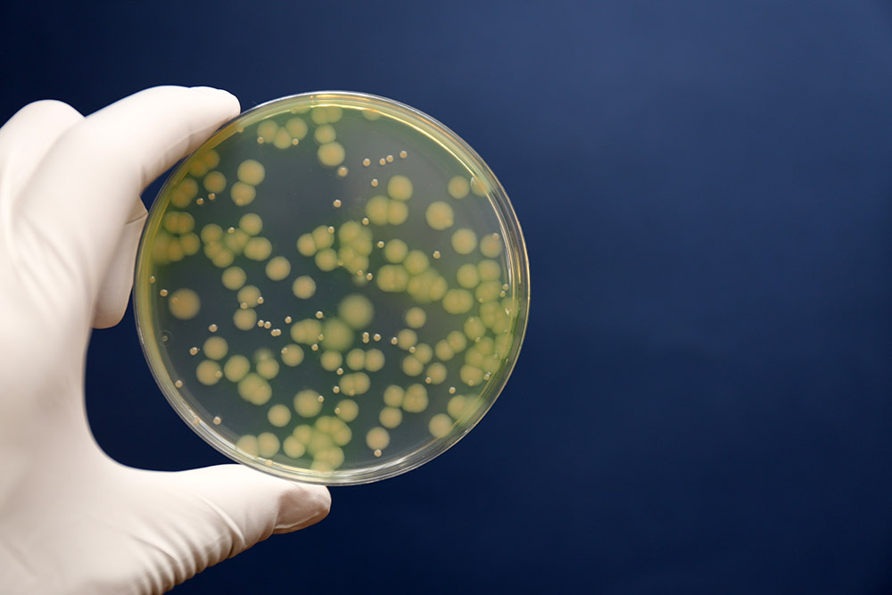 Professor of Microbiology Rachel Whitaker, with graduate students Whitney England and Ted Kim, are using pseudomonas aeruginosa as a model system for health effects of viral/bacteria interactions. 