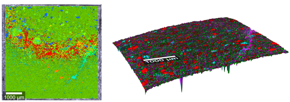 Figure 5mm2